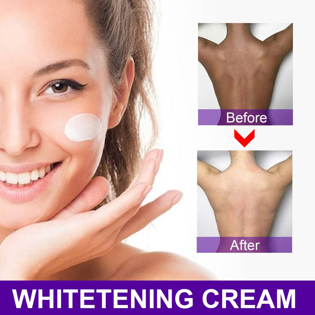 Beauty Cream, Whitening And Brightening Skin Moisturizes Skin Care Cream eprolo